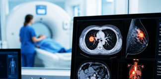 Nowotwory – dlaczego tak ważna jest wczesna diagnostyka?
